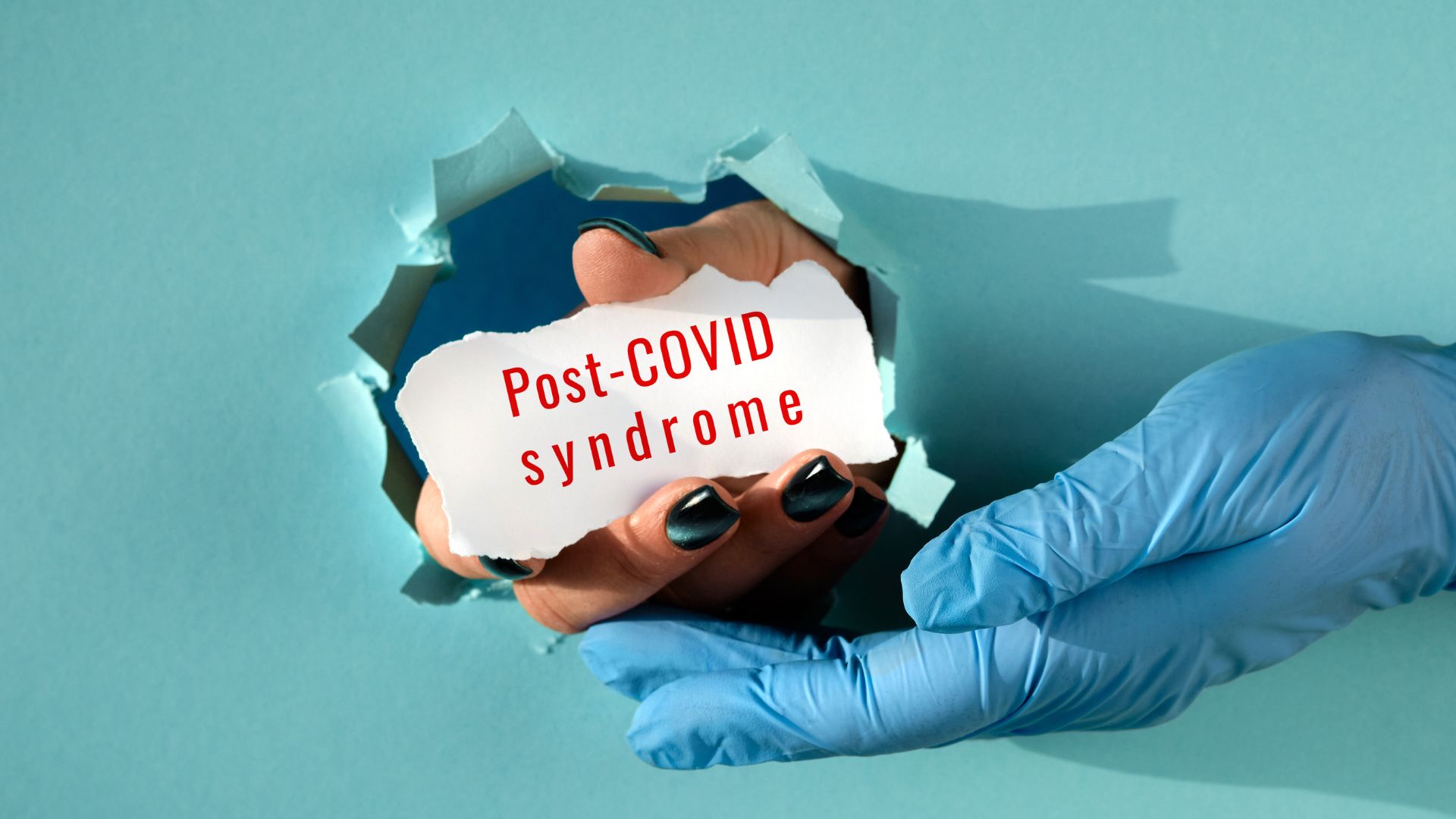 Post-covid syndrome